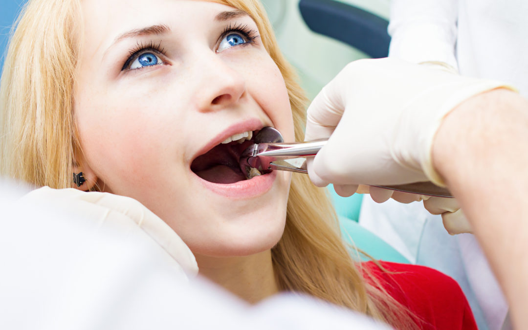 Why Is Removing Wisdom Teeth Important?